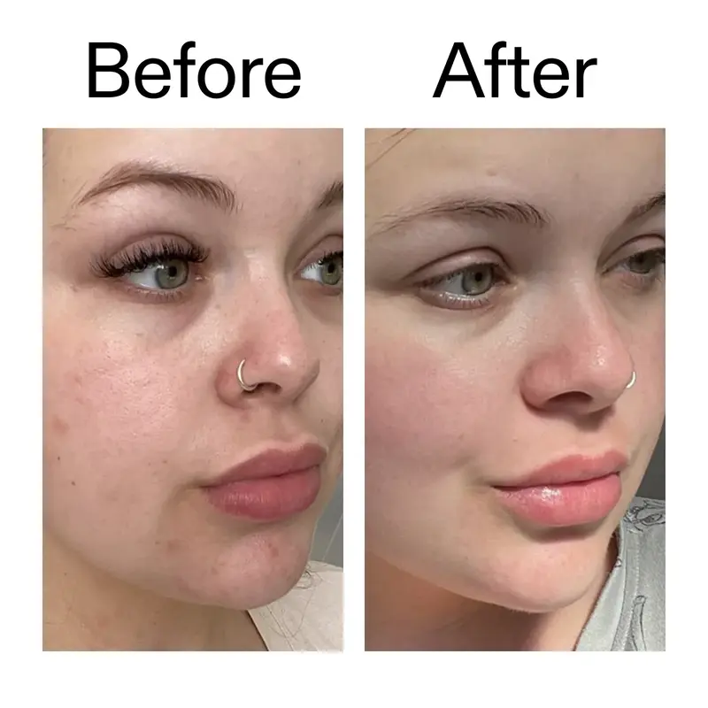 Omega50_Before_After_2000x2000_46483ed8-3f9d-487f-9a0c-9df79830bd65_1600x_crop_center کرم مرطوب کننده امگا واتر اینکی لیست The Inkey List Omega Water Cream - Image 2